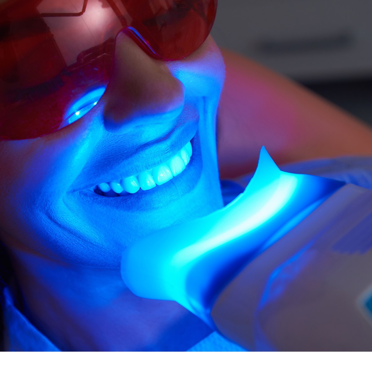 Whitening kit